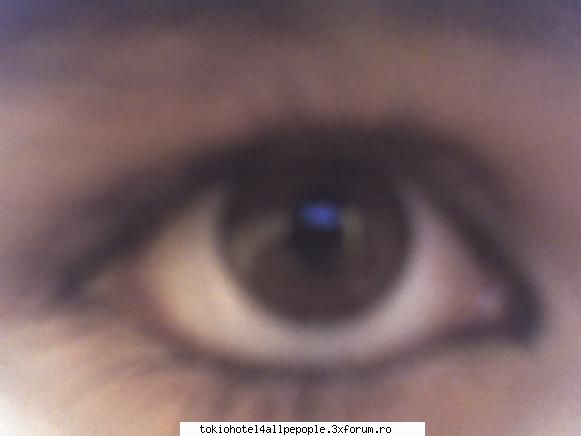my eye
